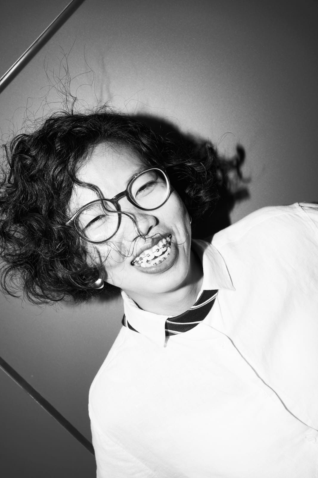 99 Days Into Braces: Cultural Standards, Crooked Teeth, and the Freedom to Smile
